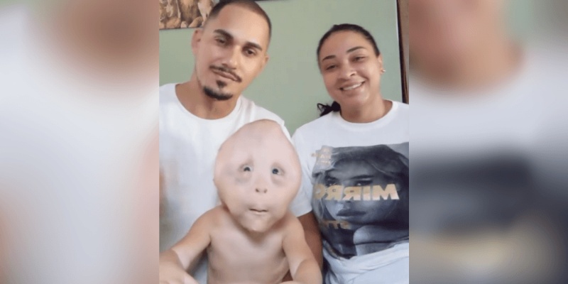 Gabriel, chamado Biel, bebê retratado na campanha de apoio da família